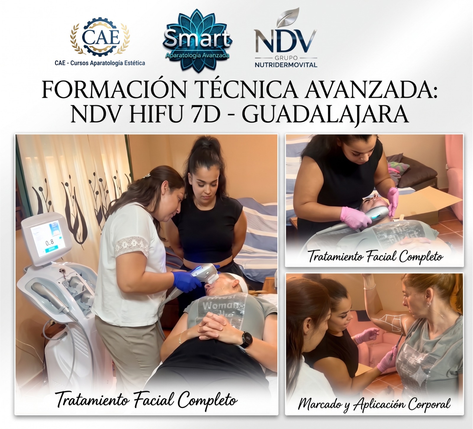 Nueva instalación del NDV HIFU 7D en Guadalajara con formación técnica avanzada